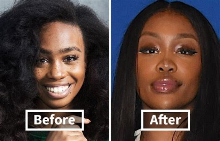 Alondradessy Before BBL | Plastic Surgery Transformation