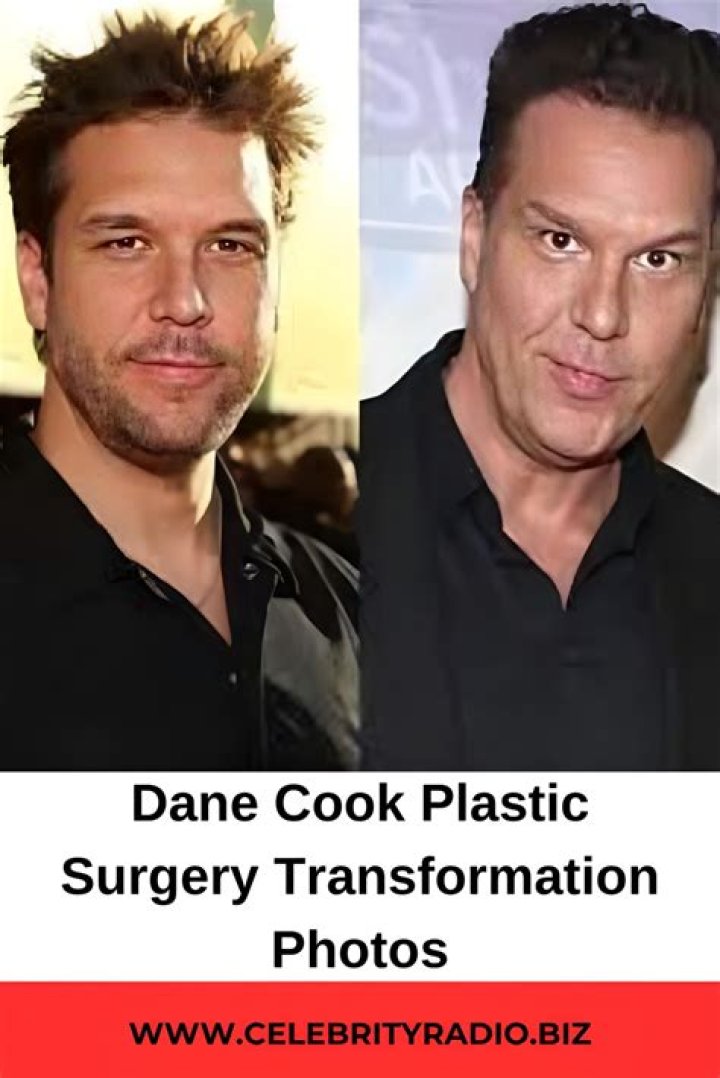 Dane Cook Has Had Plastic Surgery Because Of His Weight Loss