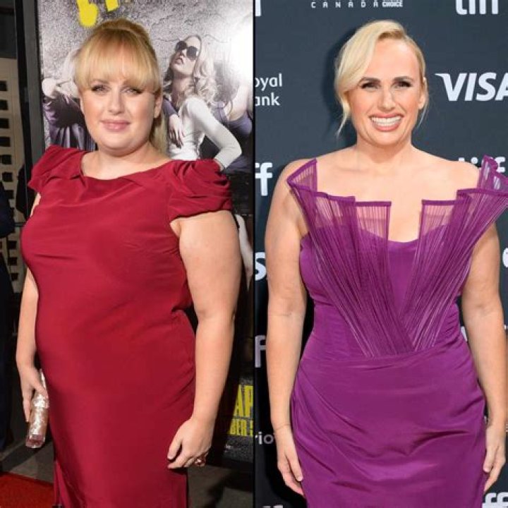 Kari Lake | Weight Loss Before And After: Done Plastic Surgery?