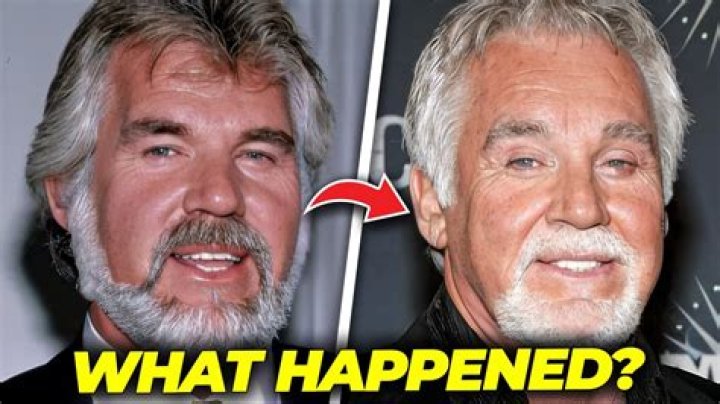 Kenny Rogers | Did He Have Dementia? What Caused His Death, If Any