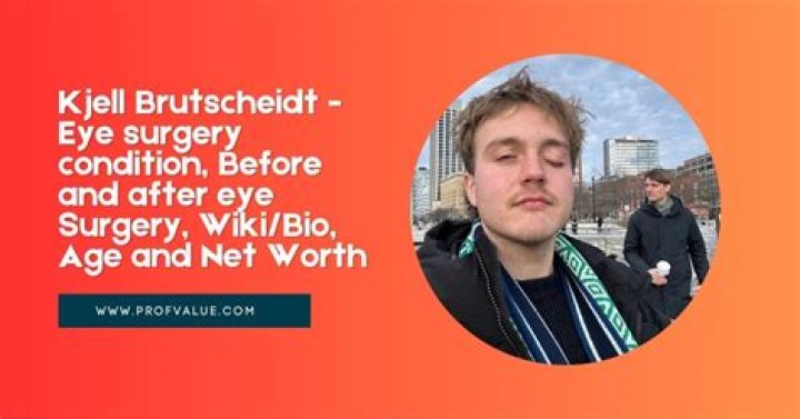 Kjell Brutscheidt: Eye surgery condition, Before and after eye Surgery